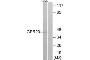 Western blot analysis of extracts from LOVO cells, using GPR20 antibody. (GPR20 Antikörper  (C-Term))