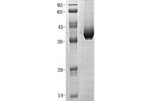 Western Blotting (WB) image for Malate Dehydrogenase 1, NAD (Soluble) (MDH1) (Transcript Variant 1) protein (His tag) (ABIN2725671)