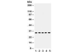 Western blot testing of 1) rat kidney, 2) rat lung, 3) rat heart, 4) rat PC-12 and 5) mouse HEPA lysate with Aquaporin 1 antibody. (Aquaporin 1 Antikörper)