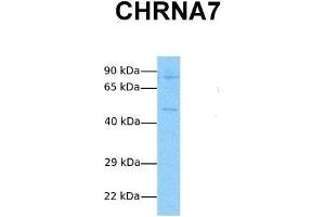Host:  Rabbit  Target Name:  CHRNA7  Sample Tissue:  Human Jurkat  Antibody Dilution:  1. (CHRNA7 Antikörper  (N-Term))