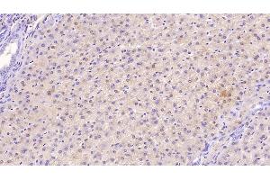 Detection of TFR in Human Liver Tissue using Monoclonal Antibody to Transferrin Receptor (TFR) (Transferrin Receptor Antikörper  (AA 567-744))