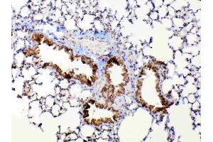 IHC analysis of MMP13 using anti-MMP13 antibody . (MMP13 Antikörper  (AA 99-335))