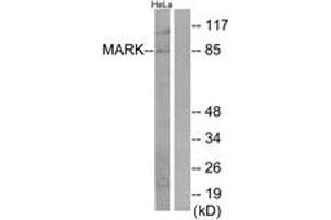 Western Blotting (WB) image for anti-MAP/microtubule Affinity-Regulating Kinase 1/2/3/4 (MARK1/2/3/4) (AA 121-170) antibody (ABIN2889783) (MARK1/2/3/4 Antikörper  (AA 121-170))
