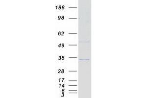 Validation with Western Blot (Septin 4 Protein (SEPT4) (Transcript Variant 2) (Myc-DYKDDDDK Tag))