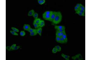 Immunofluorescence staining of HepG2 cells with ABIN7147581 at 1:100, counter-stained with DAPI. (CLCNKB Antikörper  (AA 538-687))
