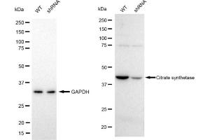 Western blotting analysis using Citrate synthetase antibody (ABIN7798088). (Rekombinanter Citrate Synthetase Antikörper)