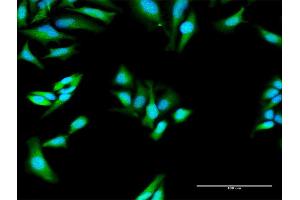 Immunofluorescence of purified MaxPab antibody to MX1 on HeLa cell. (MX1 Antikörper  (AA 1-662))