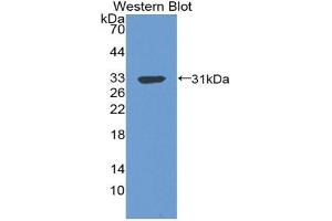Detection of Recombinant C4BPb, Human using Polyclonal Antibody to C4 Binding Protein Beta (C4BPb) (C4BPB Antikörper  (AA 18-252))