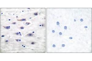 Immunohistochemistry analysis of paraffin-embedded human brain tissue, using GluR1 (Ab-863) Antibody. (Glutamate Receptor 1 Antikörper  (AA 829-878))