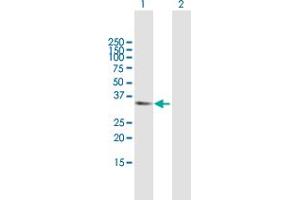 Western Blotting (WB) image for anti-Amyloid beta (A4) Precursor Protein-Binding, Family B, Member 2 (APBB2) (AA 1-329) antibody (ABIN947564)