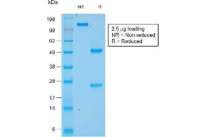 SDS-PAGE Analysis of Purified Chromogranin A Mouse Recombinant Monoclonal Antibody (rCHGA/777). (Rekombinanter Chromogranin A Antikörper)