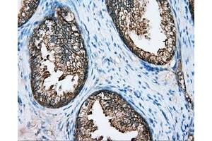 Immunohistochemical staining of paraffin-embedded Kidney tissue using anti-DNTTIP1 mouse monoclonal antibody. (DNTTIP1 Antikörper)