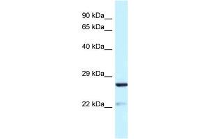 WB Suggested Anti-Yipf5 Antibody   Titration: 1. (YIPF5 Antikörper  (N-Term))
