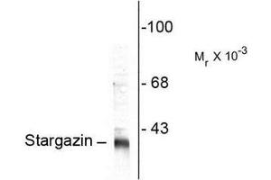 Image no. 1 for anti-Calcium Channel, Voltage-Dependent, gamma Subunit 2 (CACNG2) (C-Term) antibody (ABIN372715) (Stargazin Antikörper  (C-Term))