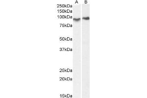 Western Blotting (WB) image for anti-ArfGAP with Coiled-Coil, Ankyrin Repeat and PH Domains 2 (ACAP2) (C-Term) antibody (ABIN185097)