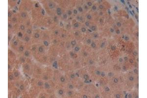 Immunohistochemistry (IHC) image for anti-Leukocyte Immunoglobulin-Like Receptor, Subfamily B (With TM and ITIM Domains), Member 2 (LILRB2) (AA 53-255) antibody (ABIN7444112)