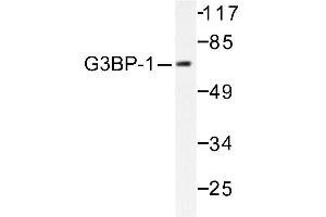 Image no. 1 for anti-GTPase Activating Protein (SH3 Domain) Binding Protein 1 (G3BP1) antibody (ABIN265425) (G3BP1 Antikörper)