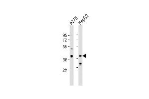 All lanes : Anti-DHRS3 Antibody (Center) at 1:1000 dilution Lane 1:  whole cell lysate Lane 2: HepG2 whole cell lysate Lysates/proteins at 20 μg per lane.