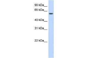 WB Suggested Anti-KLHDC5 Antibody Titration:  0. (KLHDC5 Antikörper  (Middle Region))