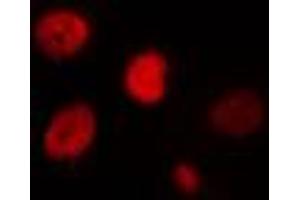 ABIN6274435 staining HT29 cells by IF/ICC. (IPMK Antikörper  (Internal Region))