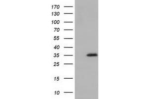 Western Blotting (WB) image for anti-Short Chain Dehydrogenase/reductase Family 9C, Member 7 (SDR9C7) antibody (ABIN1500841) (SDR9C7 Antikörper)