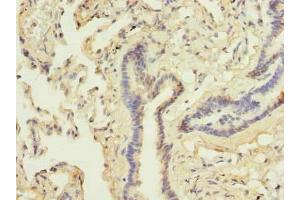 Immunohistochemistry of paraffin-embedded human lung tissue using ABIN7144990 at dilution of 1:100 (DDX42 Antikörper  (AA 519-819))