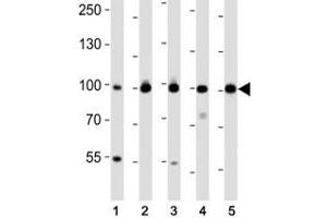 Western blot analysis of lysate from (1) MDA-MB-468, (2) SW620, (3) T47D cell line, (4) mouse spleen, (5) mouse testis tissue using EZH2 antibody at 1:1000. (EZH2 Antikörper)