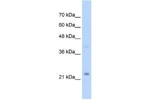MUC1 antibody used at 2. (MUC1 Antikörper  (C-Term))