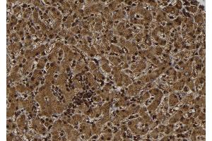 ABIN6261588 and ABIN6277499 at 1/100 staining Human liver tissue by IHC-P. (ERCC1 Antikörper  (Internal Region))