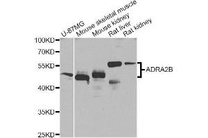 Western blot analysis of extracts of various cell lines, using ADRA2B Antibody (ABIN5996019) at 1/1000 dilution. (ADRA2B Antikörper)