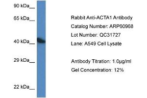 Western Blotting (WB) image for anti-Actin, alpha 1, Skeletal Muscle (ACTA1) (C-Term) antibody (ABIN786304) (Actin Antikörper  (C-Term))