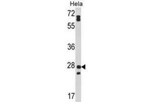 Image no. 1 for anti-Family with Sequence Similarity 3, Member B (FAM3B) (N-Term) antibody (ABIN452988) (FAM3B Antikörper  (N-Term))