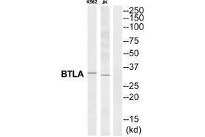 Western blot analysis of extracts from K562/Jurkat cells, using BTLA antibody. (BTLA Antikörper  (C-Term))