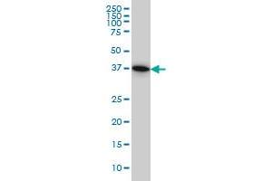 Western Blotting (WB) image for anti-Protein Geranylgeranyltransferase Type I, beta Subunit (PGGT1B) (AA 1-105) antibody (ABIN562194)