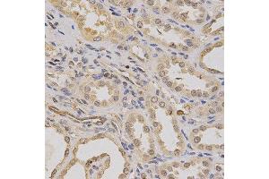 Immunohistochemistry (IHC) image for anti-ATPase, H+ Transporting, Lysosomal Accessory Protein 1 (ATP6AP1) (AA 90-390) antibody (ABIN3021730)
