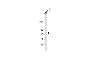 Anti-DDR1 Antibody (N-term) at 1:2000 dilution + MCF-7 whole cell lysate Lysates/proteins at 20 μg per lane.