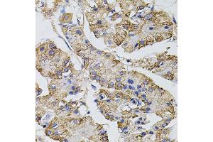Immunohistochemistry of paraffin-embedded human stomach using CAST antibody. (Calpastatin Antikörper)