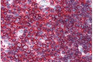 Human Thymus (formalin-fixed, paraffin-embedded) stained with SPN antibody ABIN351514 at 10 ug/ml followed by biotinylated anti-mouse IgG secondary antibody ABIN481714, alkaline phosphatase-streptavidin and chromogen. (CD43 Antikörper)