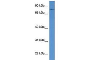 Image no. 1 for anti-Protein O-Linked Mannose Beta1,2-N-Acetylglucosaminyltransferase (POMGNT1) (AA 47-96) antibody (ABIN6746294) (POMGNT1 Antikörper  (AA 47-96))