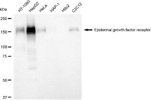 Western blotting analysis using epidermal growth factor receptor antibody (ABIN7798478). (Rekombinanter EGFR Antikörper)