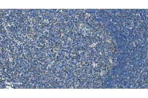 IHC analysis of IL37 using anti-IL37 antibody (ABIN7601794). (IL-37 Antikörper  (AA 46-218))