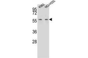 Western Blotting (WB) image for anti-Membrane Protein, Palmitoylated 3 (MAGUK P55 Subfamily Member 3) (MPP3) (AA 405-434), (C-Term) antibody (ABIN953492)