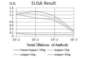 Black line: Control Antigen (100 ng), Purple line: Antigen(10 ng), Blue line: Antigen (50 ng), Red line: Antigen (100 ng), (NEFL Antikörper)
