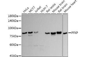 Western blot analysis of extracts of various cell lines, using PFKP antibody (ABIN7269309) at 1:1000 dilution. (PFKP Antikörper)