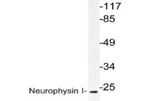 Western blot analysis of Neurophysin I Antibody in extracts from K562 cells. (OXT Antikörper)