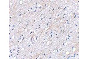 Immunohistochemical staining of human brain tissue using BAIAP3 polyclonal antibody  at 5 ug/mL . (BAIAP3 Antikörper  (N-Term))