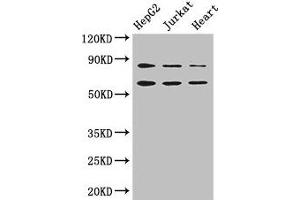 Western Blot Positive WB detected in: HepG2 whole cell lysate, Jurkat whole cell lysate, Mouse heart tissue All lanes: STIM2 antibody at 2.