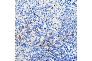 Immunohistochemistry of paraffin-embedded mouse spleen using IL24 Rabbit pAb (ABIN6128082, ABIN6142368, ABIN6142369 and ABIN6219012) at dilution of 1:100 (40x lens). (IL-24 Antikörper  (AA 52-140))