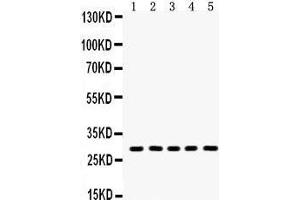 Anti- Aquaporin 1 Picoband antibody, Western blotting All lanes: Anti Aquaporin 1  at 0. (Aquaporin 1 Antikörper  (C-Term))