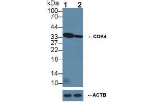 Western blot analysis of (1) Wild-type HeLa cell lysate, and (2) CDK4 knockout HeLa cell lysate, using Rabbit Anti-Human CDK4 Antibody (1 µg/ml) and HRP-conjugated Goat Anti-Mouse antibody (abx400001, 0.